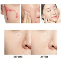 Esthetic House Toxheal Red Glycolic Peeling Serum šveičiamasis serumas su glikolio rūgštimi